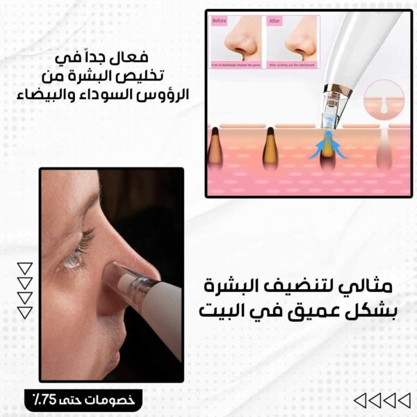 ⁦جهاز تنظيف مسام الوجه⁩ - الصورة ⁦3⁩