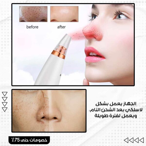 ⁦جهاز تنظيف مسام الوجه⁩ - الصورة ⁦5⁩