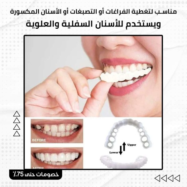 ⁦سناب أون سمايل⁩ - الصورة ⁦3⁩
