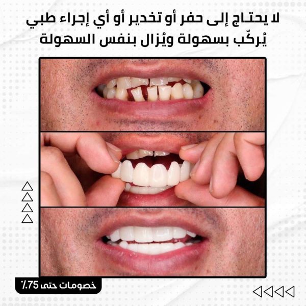 ⁦سناب أون سمايل⁩ - الصورة ⁦4⁩